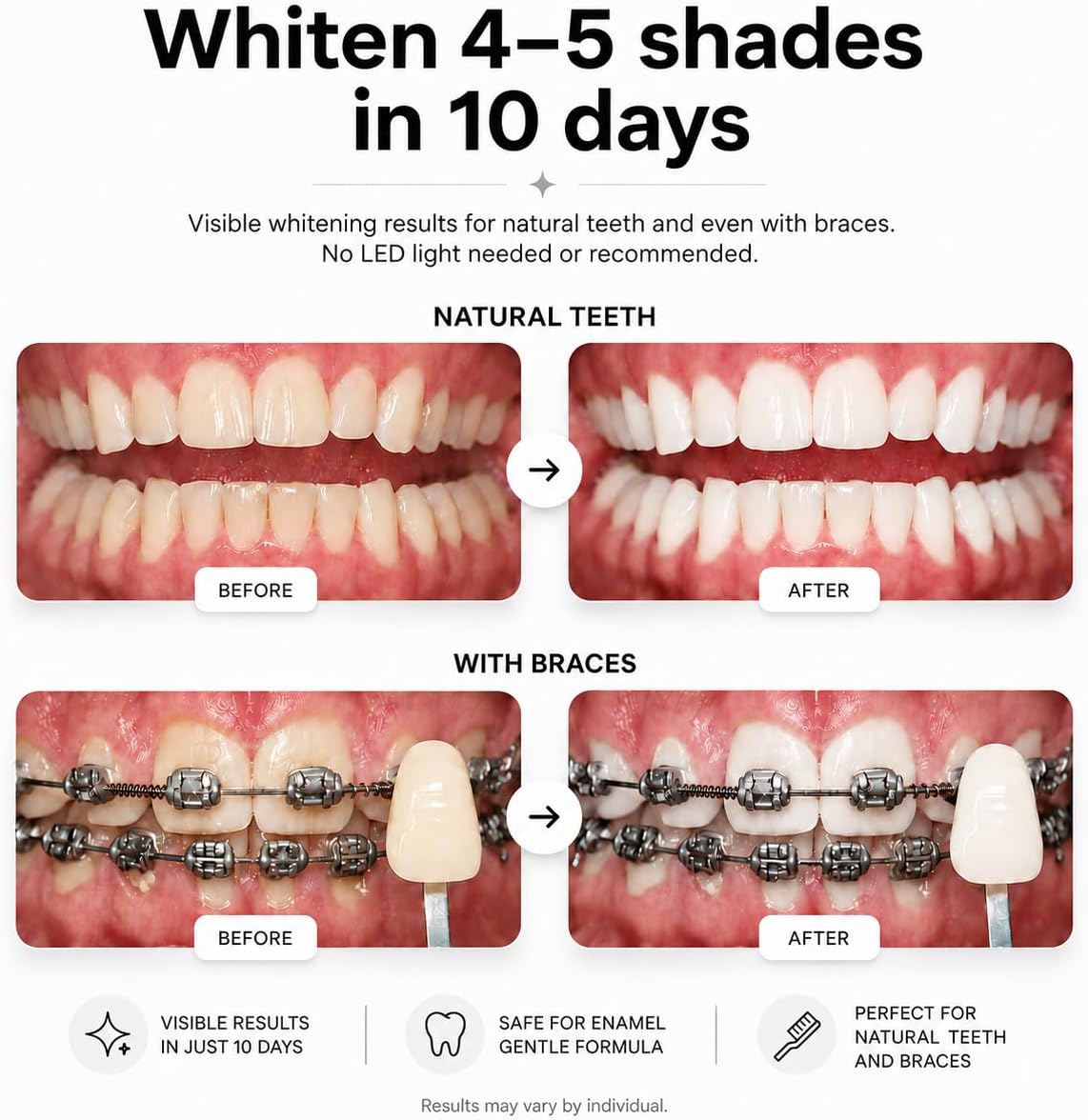 Opalescence Go 15% Mint - Prefilled Teeth Whitening Trays - 5194